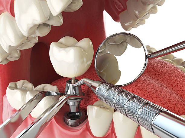 Best Urgent Tooth Repair  in Morganfield, KY